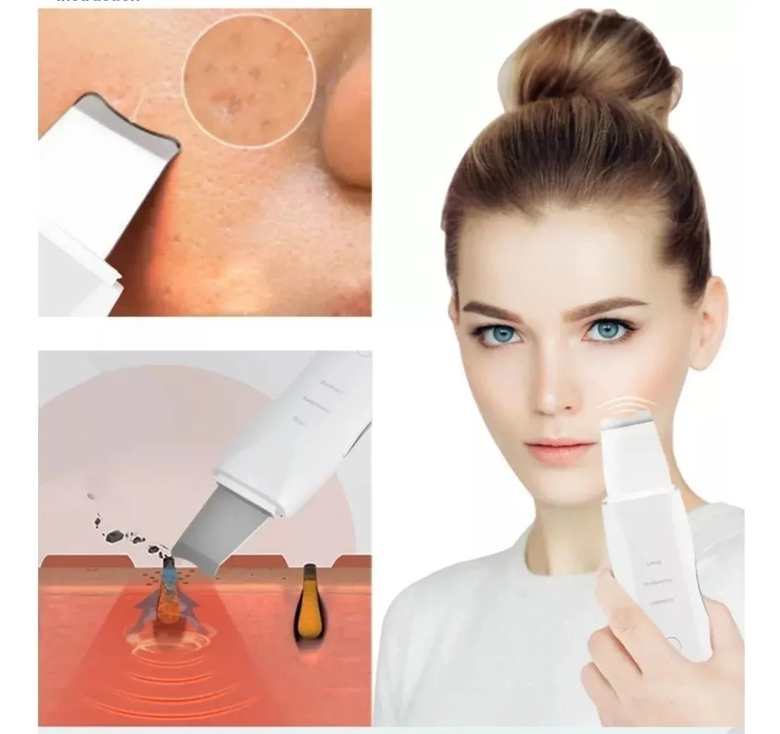 LIMPIADOR ULTRASÓNICO FACIAL